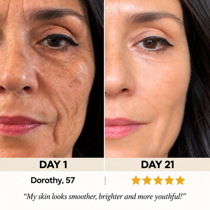 Olivora – Kojic Acid, Turmeric & Collagen Overnight Mask